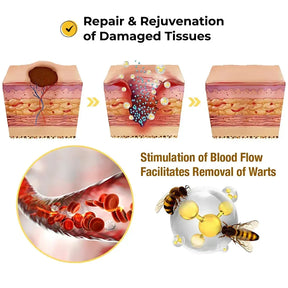 Derma Smooth Skin Tag Removal Patch - 72 Patches