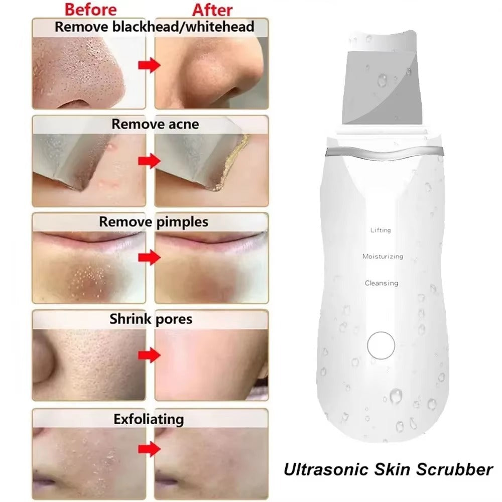 Ultrasonic Facial Skin Scrubber – Deep Cleanse & Glowing Skin in Minutes!
