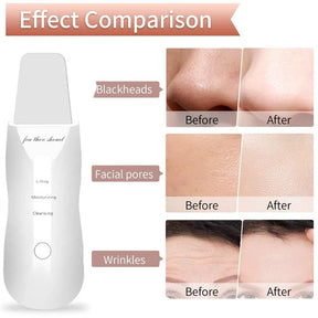 Ultrasonic Facial Skin Scrubber – Deep Cleanse & Glowing Skin in Minutes!