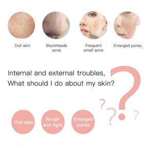 Ultrasonic Facial Skin Scrubber – Deep Cleanse & Glowing Skin in Minutes!